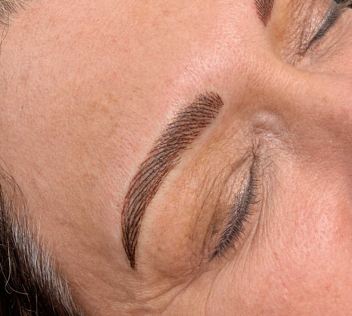 nano-brows-2-Immediately-After-Treatment